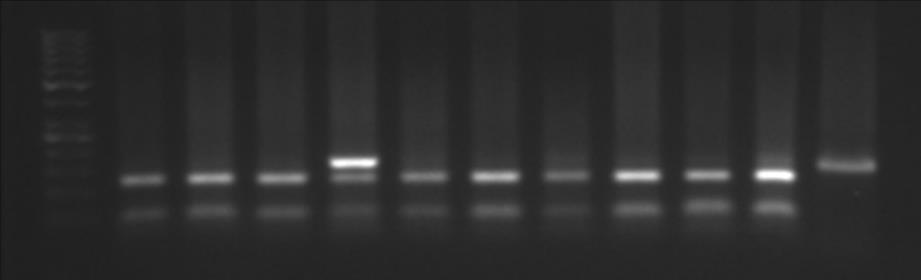 Para a digestão do DNA amplificado do PTCR, foi preparado um mix contendo Água Milli Q 17 µl, tampão NEBuffer 2 (2 µl) (Thermo Scientific, USA), alíquota da amostra amplificação (10 µl) e enzima de