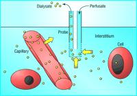 Microdiálise Monitorização invasiva do espaço extracelular cerebral