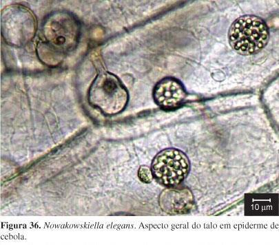 Micélio contínuo (cenocítico) ausente ou pouco desenvolvido Estrutura de reprodução assexuada: zoosporângio Chytridiomycota Esporo flagelado (móvel)