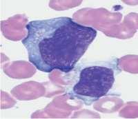 Os linfócitos B podem transformar-se em imunoblastos (células grandes