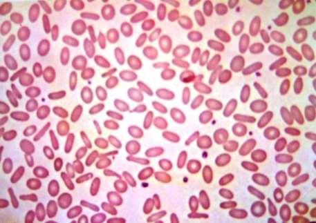 Ovalócitos ou eliptócitos são eritrócitos com forma ovalada. Possuem uma agregação bipolar de hemoglobina.