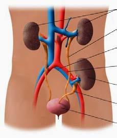 Tratamento: Transplante Renal Experiência limitada Estimado: 170 transplantes entre 1989-2011 sobrevida 56% vs.