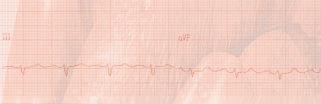 AGRADECIMENTOS Gostaríamos de agradecer a todos aqueles que contribuíram na busca ativa diária de Eletrocardiogramas e também em suas coleções de