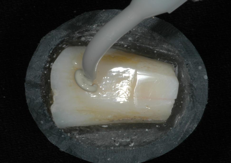 22 Figura 12 Aplicação do produto pasta de polimento Diamond Excel (FGM - Produtos Odontológicos).