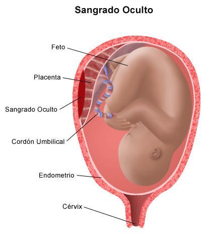 βhcg deve ser realizada semanalmente após o esvaziamento uterino até que seus valores se mostrem declinantes e os resultados sejam negativos por três dosagens consecutivas. Fique Ligado!