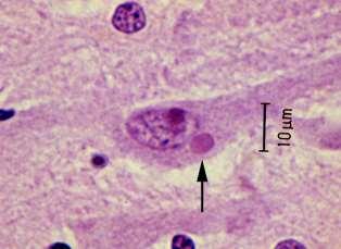 Infecções líticas Mecanismos de dano