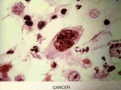 Herpesvírus) Transformante (vírus oncogênicos): infecção viral promove o crescimento
