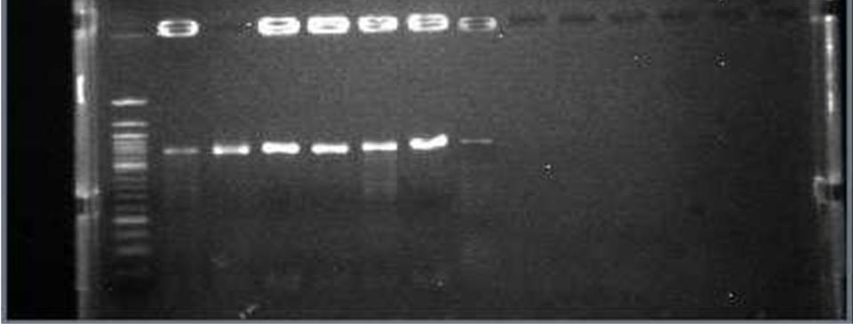 107 Anexo 2 Gel de agarose a 1% demonstrando a amplificação do gene vana.