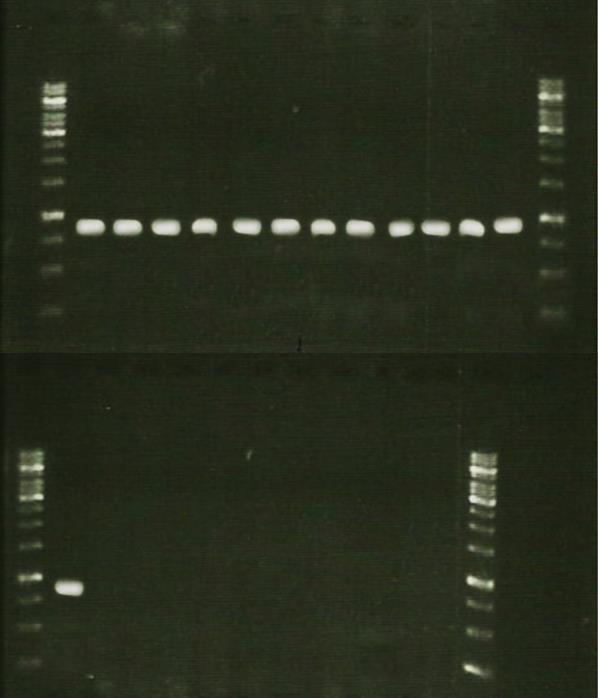 108 Anexo 3 - Produtos de amplificação do gene de virulência (acm) das cepas de E. faecium após eletroforese em gel de agarose 1%.