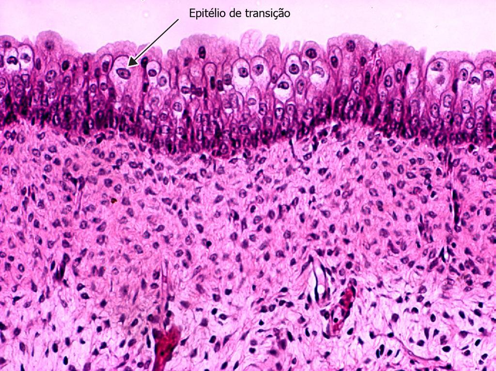 10 Tecido epitelial pavimentoso estratificado queratinizado