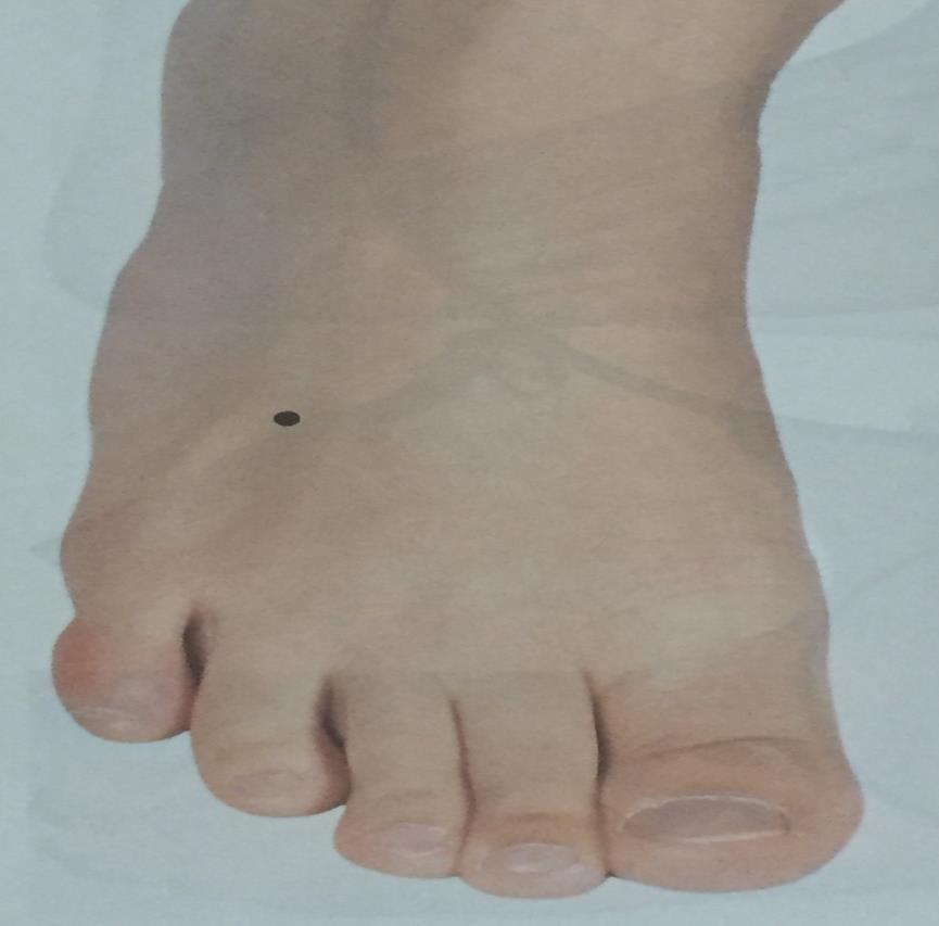 Dài Mài - Vaso da Cintura ou do Cinto Ponto Mestre Dài Mài Zúlínqì (VB-41) Localização: Face dorso lateral do pé, na depressão interóssea da transição