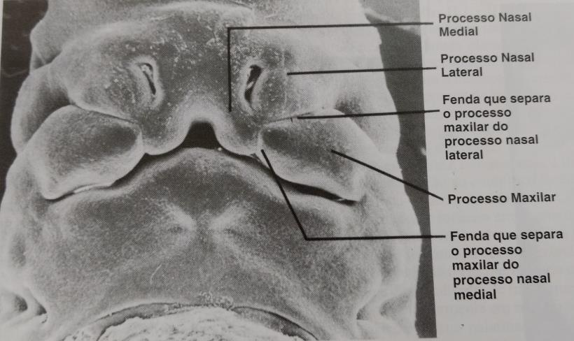 5 lateralmente pelo processo maxilar e ventralmente pelo primeiro arco, ou seja, o processo mandibular (TEN CATE, 2001).