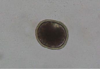 paratênico (galinha, bovino e suíno) como uma carne crua ou mal cozida leva ao desenvolvimento do parasito (SÖHSTEN & SILVA, 2015).