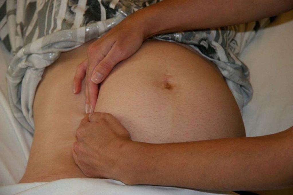Manual left uterine displacement by the 2-handed technique from the left of the patient. Farida M.
