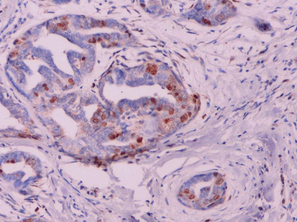 Imuno-reatividade do anticorpo anti-pcna no núcleo das células