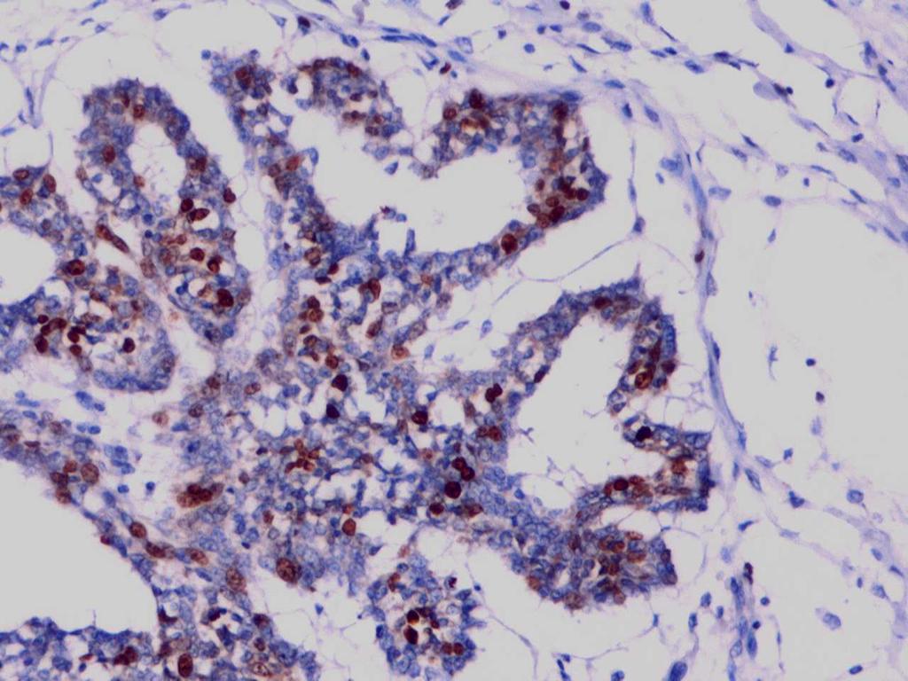Imuno-reatividade das células epiteliais dos ductos glandulares em