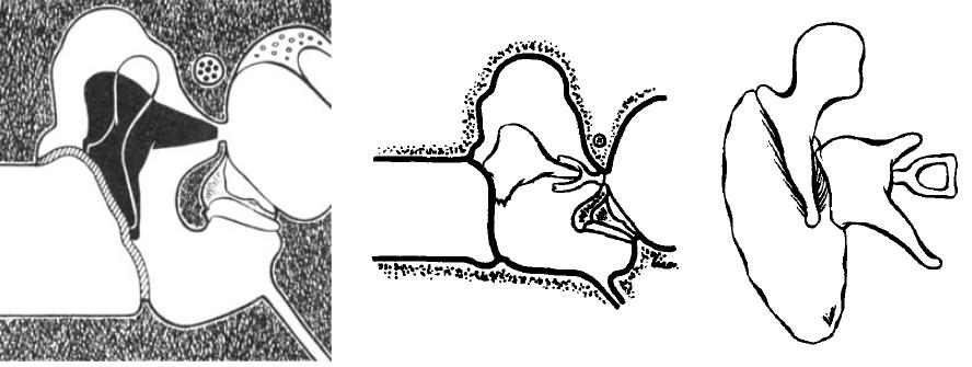 Relataram ainda 4 casos de reoperação, em que se pôde ver boa vascularização da bigorna interposta. 36 A B C Figura 2 Primeiras representações esquemáticas da interposição de bigorna.