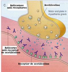 Disfunção celular mediada por anticorpos Os anticorpos são dirigidos contra receptores localizados na superfície celular.