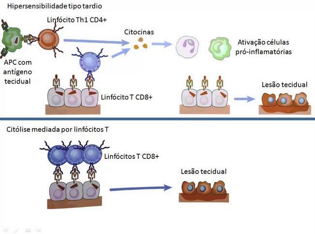 Hipersensibilidade do tipo IV Sensibilidade do tipo tardia Desencadeadas por LT CD4 ou por LT CD8 Padrão de resposta contra uma variedade de