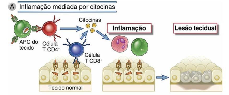 A - Nas reações inflamatórias mediadas por citocinas, as células T CD4+ (e, às vezes, as células CD8+) respondem aos
