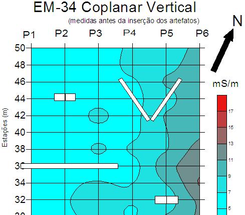 65 Figura 50 Resultados obtidos no Método Eletromagnético com o arranjo coplanar vertical (DMH) comparação: A) antes da inserção dos artefatos e B) após a inserção dos artefatos.