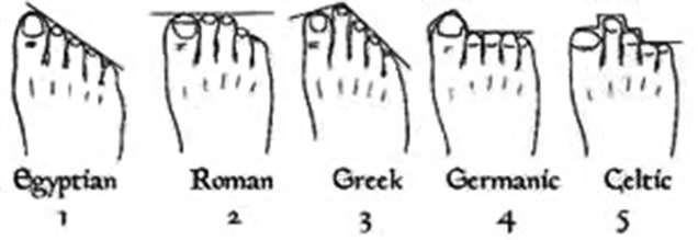 Figura 5 - Tipos de pé consoante o tamanho relativo dos dedos (3) Esta classificação revela-se bastante importante em termos epidemiológicos, na medida em que, consoante o tamanho relativo dos dedos,