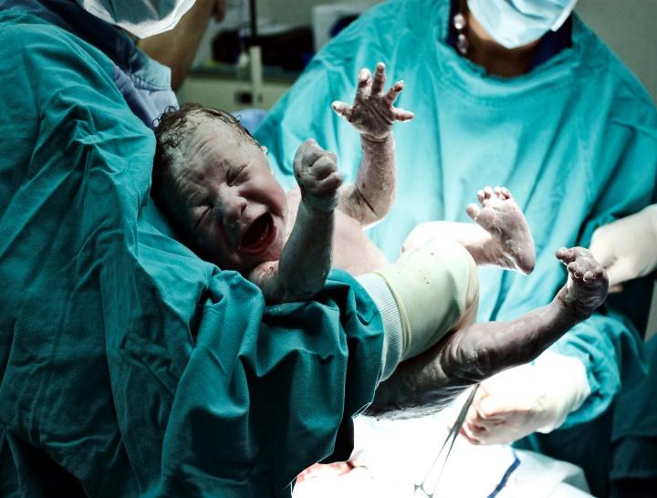 O atendimento ao RN, logo após o nascimento, pode ser realizado na própria sala de parto, em local adequado, seja na mesa, seja no berço, ou em sala anexa ao centro obstétrico, em berço aquecido.