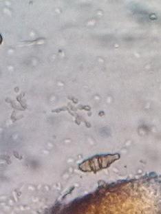 A B C D Figura 1- Laminas microscopicas de patógenos encontrados em cultivos de