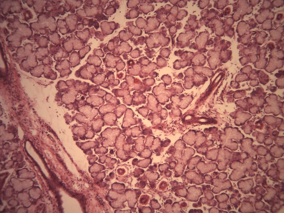 GLÂNDULA EXÓCRINA TUBULOSA ACINOSA COMPOSTA Esta glândula é constituída de ácinos e túbulos. Sua unidade secretora pode ser de 3 tipos: serosa, mucosa ou mista.