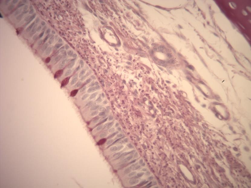 AULA PRÁTICA DE TECIDO EPITELIAL GLANDULAR IMAGENS: Historep LÂMINA C4 GLÂNDULA EXÓCRINA UNICELULAR CÉLULA CALICIFORME TRAQUÉIA - PAS As células caliciformes são glândulas exócrinas unicelulares que