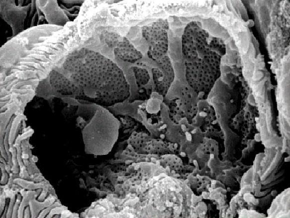 Características da membrana de filtração: o glomérulo - lâmina basal e as