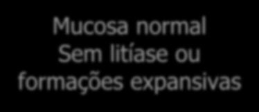 ECDs IMAGEM Ecografia renal e vesical com avaliação de RPM Rins e bexiga N Sem RPM URETROCISTOSCOPIA Em doentes