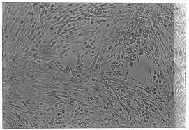 Diagnóstico laboratorial: Isolamento viral em cultivo celular Secreções respiratórias Swabs de