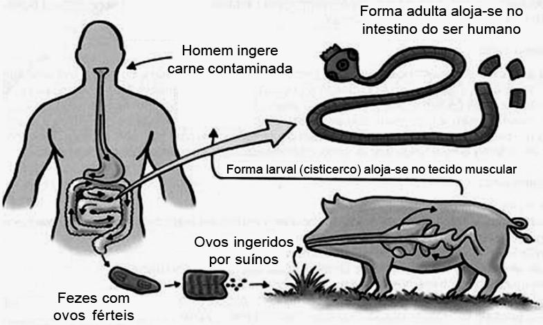 14 - (PUC RS/2011) Considere a figura e nas informações apresentadas abaixo, sobre um tipo de parasitose.