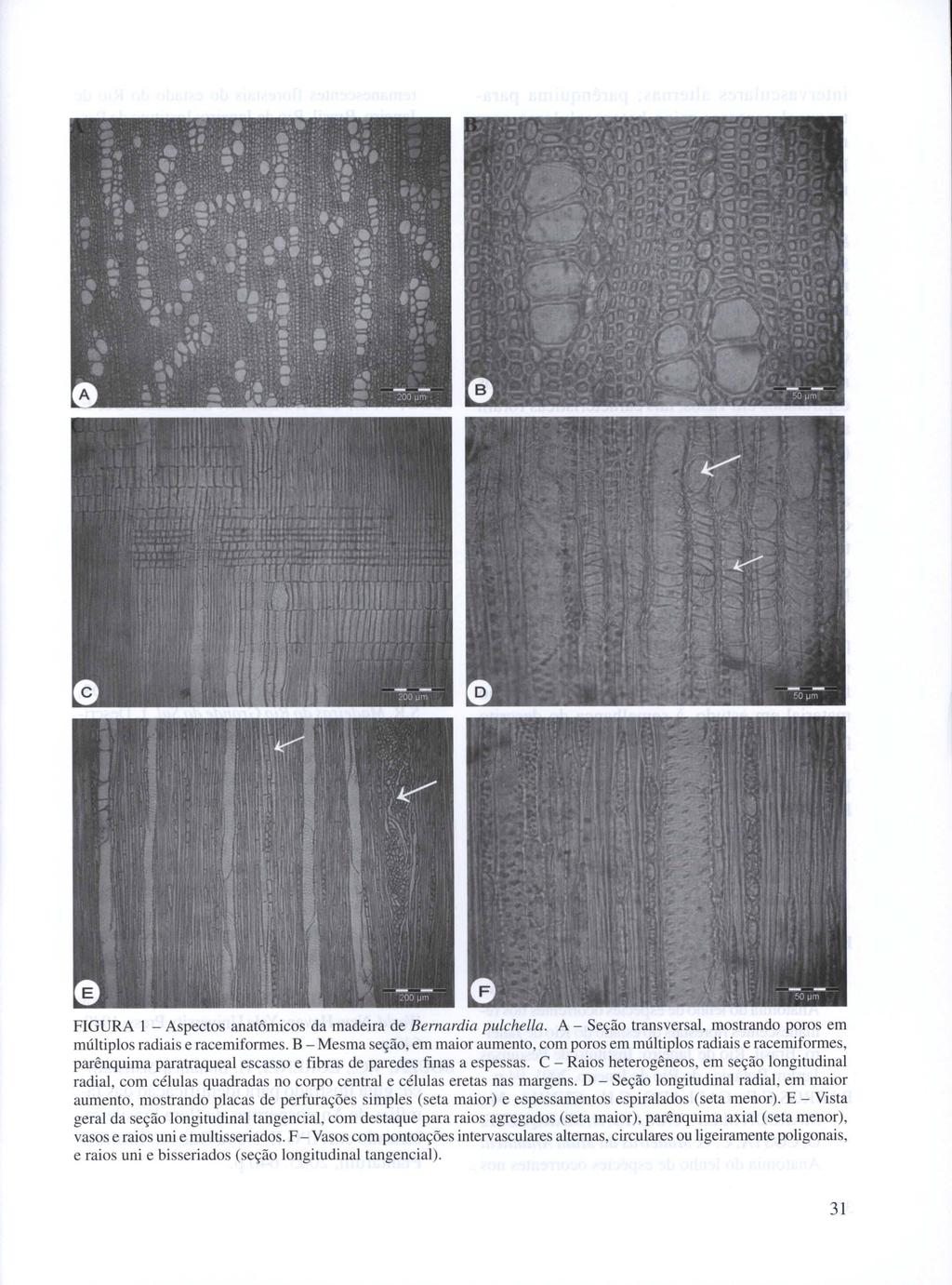 FIGURA 1 - Aspectos anatômicos da madeira de Bernardia pulchella. A - Seção transversal, mostrando poros em múltiplos radiais e racemiformes.