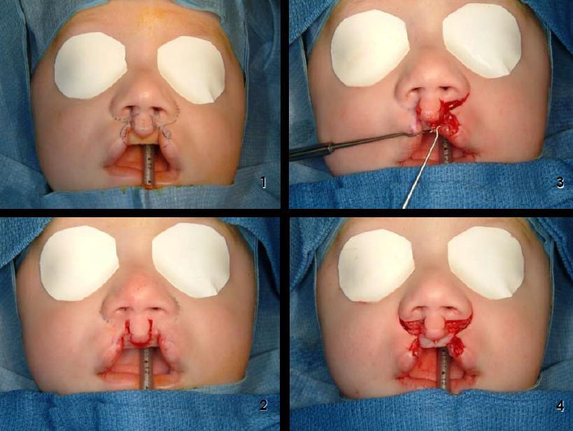 João Pedro Marcelino) Figura 15: Criança submetida a procedimento cirúrgico