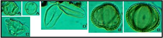 Imagem 1: Tipos polínicos mais encontrados na amostra da análise melissopalinológica de mel da Tetragonisca angustula Latreille. Família: Solanaceae (A). Oxalidaceae (B). Asteraceae (C).