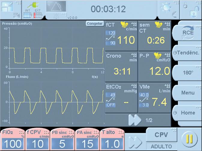 SEU APOIO Na tela: frequência de compressões torácicas por minuto. Meta: 100/min.