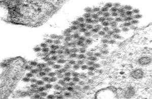 Síndrome do Choque por Dengue Teoria da Infecção sequencial (história passada de infecção pelo DENV) CDC Exacerbação imunológica (produção de grande quantidade viral) Teoria da Virulência da Cepa