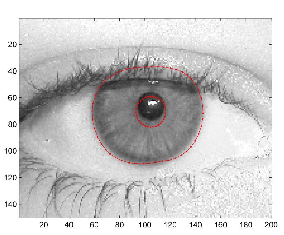 Exemplos de resultados de erro da pálpebra superior e da pupila Os erros na segmentação da borda externa da íris ocorrem quando o contraste entre a região da íris e a esclera não é alto o suficiente