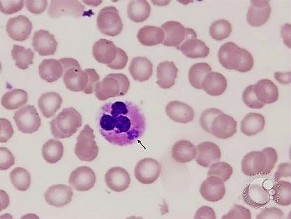 A babesiose felina é uma doença causada pelos protozoários Babesia felis e Babesia cati em gatos domésticos e pela Babesia herpailuri e Babesia pantherae em felinos selvagens de África.