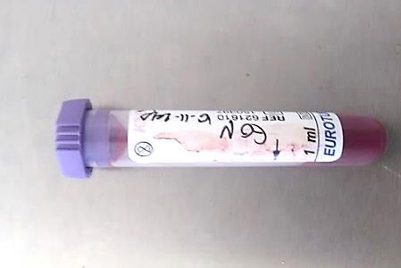 O sangue foi colhido para um tubo EDTA do qual se extraiu uma gota para realização do esfregaço (Figura 32B).