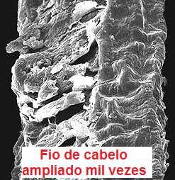 Anexos da Pele Glândulas Sudoríparas Membrana encontradas em quase toda extensão da pele e responsável pela liberação do