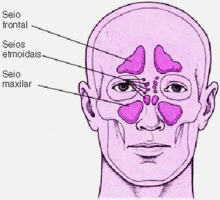 Seios frontais Estão localizados no osso frontal logo acima da cavidade nasal, sempre separado por um septo mediano.