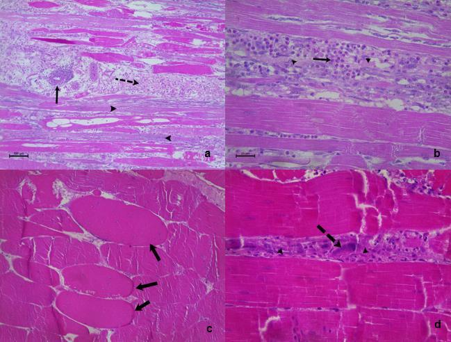 72 FIGURA 2 - ANÁLISE HISTOPATOLÓGICA DE MÚSCULO ESTRIADO ESQUELÉTICO (PECTORALIS MAJOR) ACOMETIDOS COM WOODEN BREAST. A) OBSERVA-SE ESTÁGIOS VARIADOS DE LESÃO MUSCULAR.