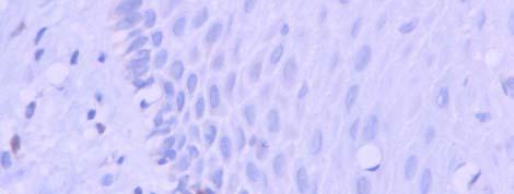 As células imunopositivas estavam presentes nas camadas basal e parabasal.