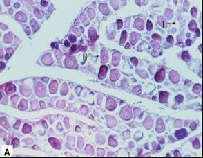 vitelogênese lipídica; IV: ovócitos em