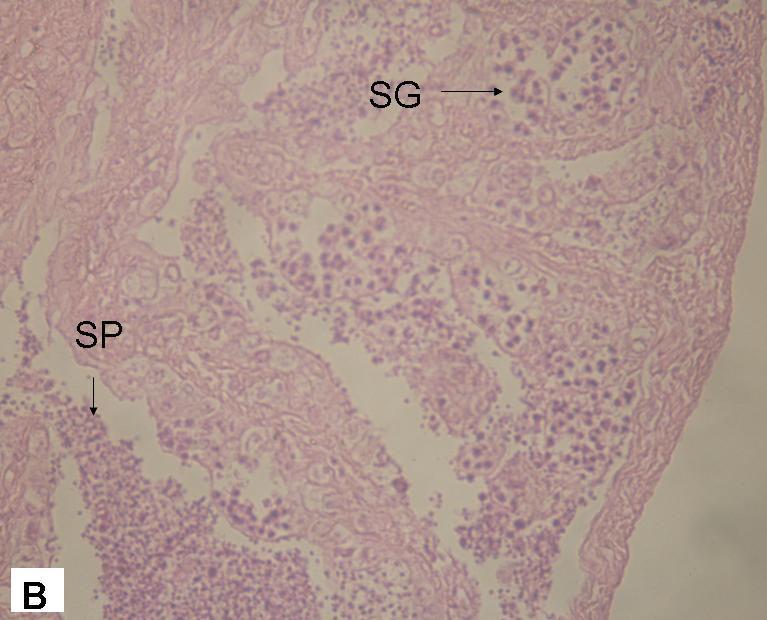espermatozóides (SP); C) testículo em maturação