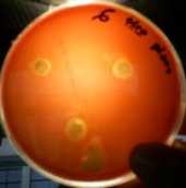 Ao se testar a atividade antimicrobiana do óleo essencial puro (obtido por hidrostilação) sobre Streptococcus sp, pode-se observar que houve formação