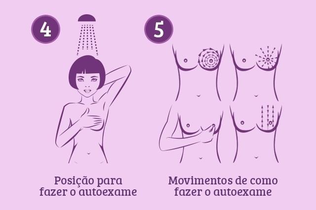 O autoexame deve ser realizado mensalmente, após a menstruação, período em que as mamas não apresentam